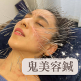 月陽堂鍼灸治療院 広島ルート治療