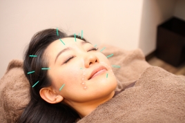 大阪屋鍼灸治療院　Harityth 美容鍼灸ベーシックコースのメニュー画像