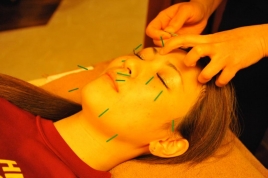 ボディメンテナンスサロン　エイチスリー表参道院 肌質改善　美顔鍼のメニュー画像