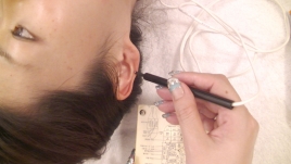 momoメディカル鍼灸院 耳鍼のメニュー画像