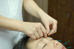 中国鍼灸院　箱嶌医針堂 全身美容鍼のメニュー画像