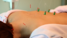 神谷総合治療センター 一般鍼灸コースのメニュー画像
