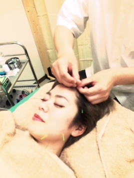 にった鍼灸治療院 美容鍼のメニュー画像