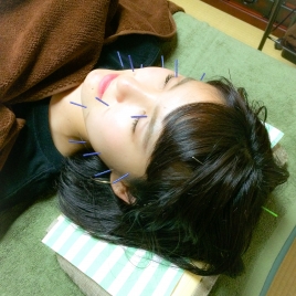 美容鍼灸サロン Hallume 初回特別価格 美容鍼 60分のメニュー画像