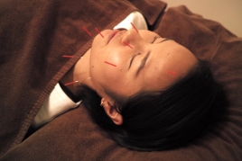 大磯治療院 美容鍼「ほうれい線SP」のメニュー画像