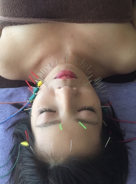 エナ鍼灸治療院 顔面電流鍼×ヘッドマッサージのメニュー画像