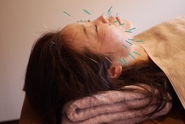 あきつ鍼灸治療院 電気を流す美顔鍼のメニュー画像
