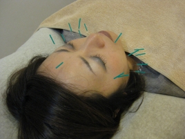ふじわら治療院 美容鍼灸のメニュー画像