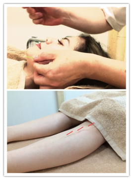 にった鍼灸治療院 トータル美容鍼灸のメニュー画像