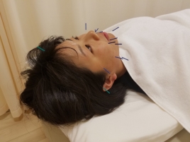 Kawai鍼灸整骨院 美容鍼灸のメニュー画像
