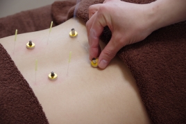 気癒鍼灸院  KIYU acupuncture 和　なごみ のメニュー画像