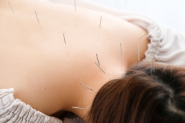美鍼灸salon紫菫-SUMIRE- 鍼灸治療のメニュー画像