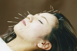 笹岡尚幸鍼灸院 電気を流す美容鍼　トライアルコースのメニュー画像