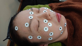 名古屋のお灸専門院　森灸温療院 森式美容灸（美顔灸＋基本施術）のメニュー画像