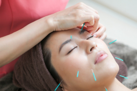 美容鍼灸サロン　sanando Re:Pro 美容鍼トライアルコースのメニュー画像