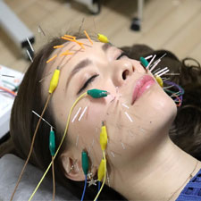 ゆず鍼灸治療院 電気を流す美容鍼コースのメニュー画像