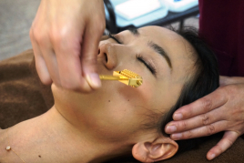 デイジークリニック（dazzy CLINIC） ゴールド美容鍼＋鍼灸 集中コース5回のメニュー画像