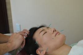 EDO鍼灸治療院 美容鍼灸レギュラー60分　のメニュー画像
