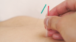 鍼灸整体院ゆるり-yururi- 腰痛専門施術のメニュー画像