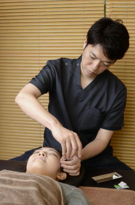 鍼灸ウインザー治療院 【初回コンパス限定】ウインザー美容鍼施術のメニュー画像