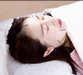 鍼灸サロンHARIDAY クイック美容鍼のメニュー画像
