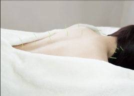 鍼灸サロンHARIDAY こり・疲れの治療鍼のメニュー画像