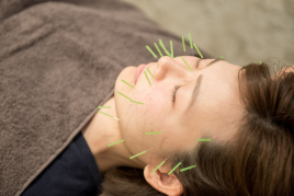 ReCORE鍼灸接骨院 糀谷 iCure式美容鍼灸のメニュー画像