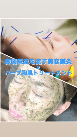 銀座美容鍼灸サロン【Mypace】 初回限定　美容鍼灸×陶肌トリートメントのメニュー画像