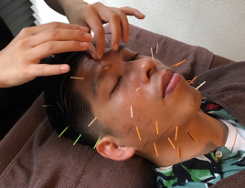 retreat鍼灸院 【男性】ベーシック美容鍼40分のメニュー画像