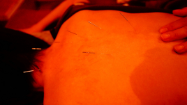 和みの手 アロマと鍼灸と指圧のコースのメニュー画像