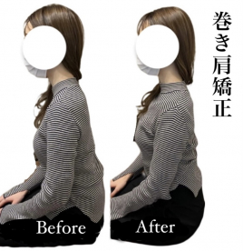 美容鍼灸整体 HARIKA 東京 新宿店 巻き肩 矯正のメニュー画像