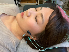 鍼灸院凪 スタンダード美容鍼のメニュー画像