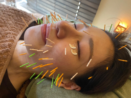 Acupuncture salon LINOA リノア鍼灸院 美容鍼灸  Basicのメニュー画像