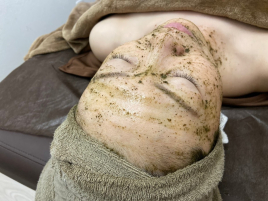美容鍼灸サロン　etoile 初回限定　美容鍼×陶肌トリートメントのメニュー画像