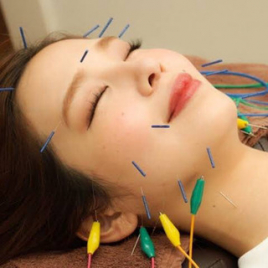 なかま鍼灸院 電気美容鍼のメニュー画像