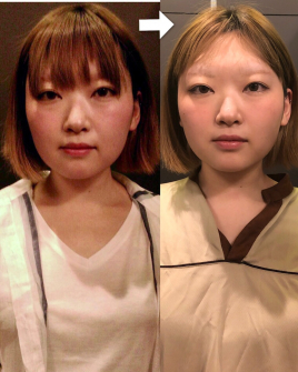 IBISOU鍼灸所沢 小顔矯正のメニュー画像