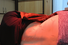 早川鍼灸院ひととき 腰痛・ぎっくり腰コースのメニュー画像