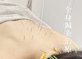 美容鍼灸整体 HARIKA 大阪 心斎橋店  全身 鍼灸治療のメニュー画像