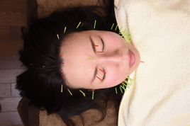 新浦安はりきゅう院 鍼灸治療+美容鍼コースのメニュー画像