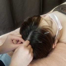 しん灸リンパLino 頭皮鍼のメニュー画像