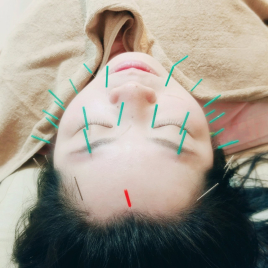 しん灸リンパLino 肌再生美容鍼のメニュー画像