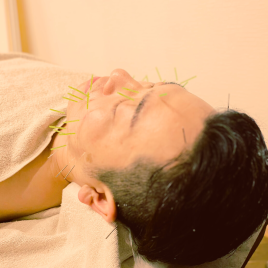 美容鍼灸サロン for your body 新大阪店 トライアルコースのメニュー画像