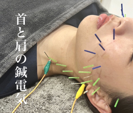 美容鍼灸整体 HARIKA 大阪 心斎橋店  首と肩の鍼電気のメニュー画像