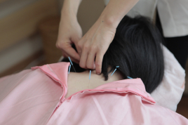鍼灸サロンMinori　浜松店 美容鍼 基本コース（女性スタッフ）のメニュー画像