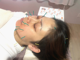 はりきゅうあきら（出張専門） 全身鍼灸＆美顔鍼コースのメニュー画像