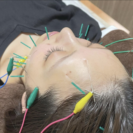 鍼灸サロン ruka 電気を流す美容鍼のメニュー画像