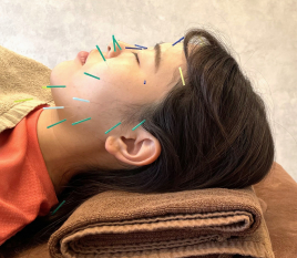 イーライフ鍼灸接骨院 美容鍼コースのメニュー画像