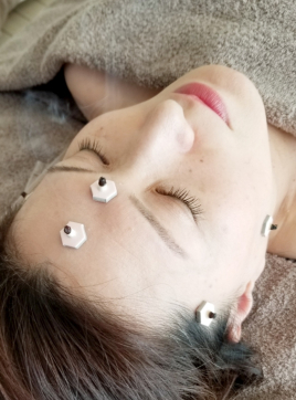 鍼灸サロン　Yasuko Ebisawa 鍼灸+ヒト幹細胞+美容鍼灸+美容矯正のメニュー画像