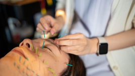 IZUMI鍼灸院 《初回限定》￥0美容鍼体験のメニュー画像