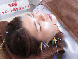 高田鍼灸カイロプラクティック 美容鍼30分のメニュー画像